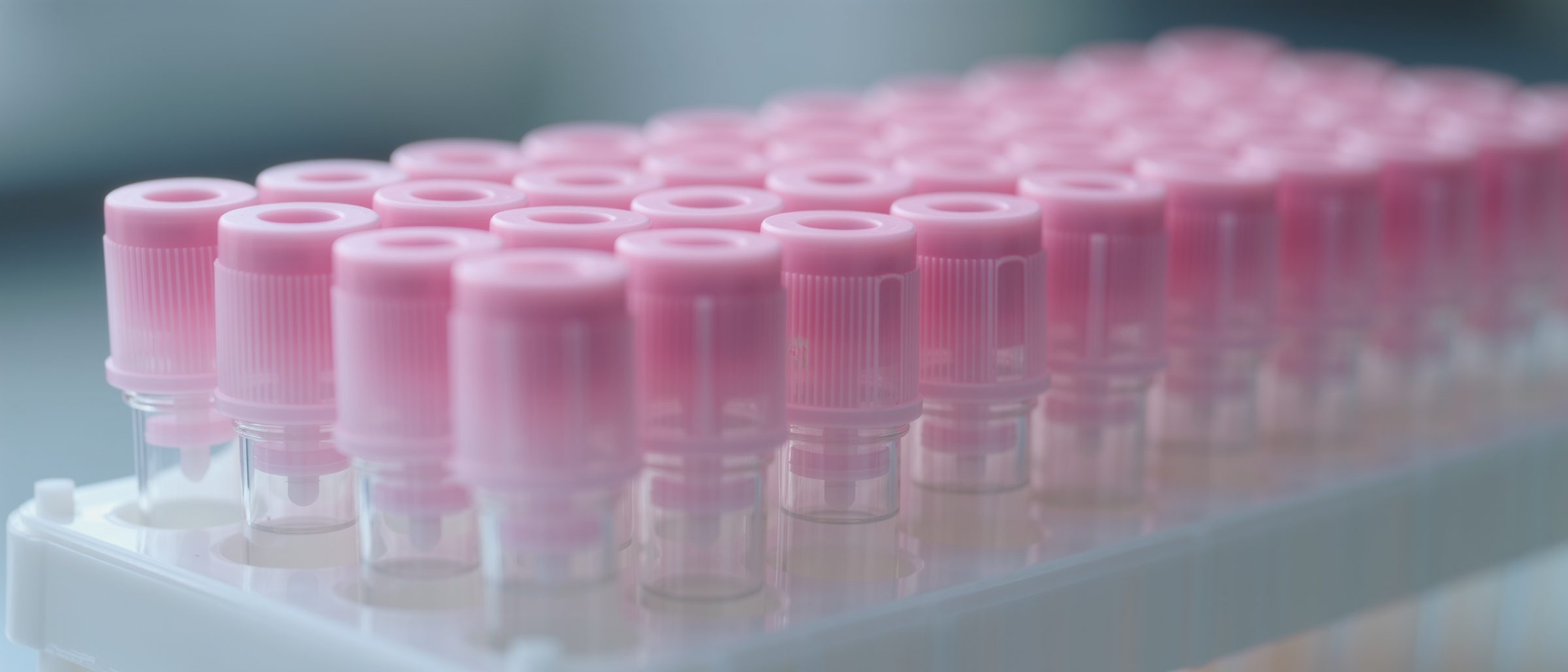 Sample tubes in a laboratory rack